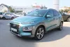 Hyundai Kona 1.6 CRDi AUTOMATIK *NAVIGACIJA,KAMERA* N1 - Teretno Thumbnail 1